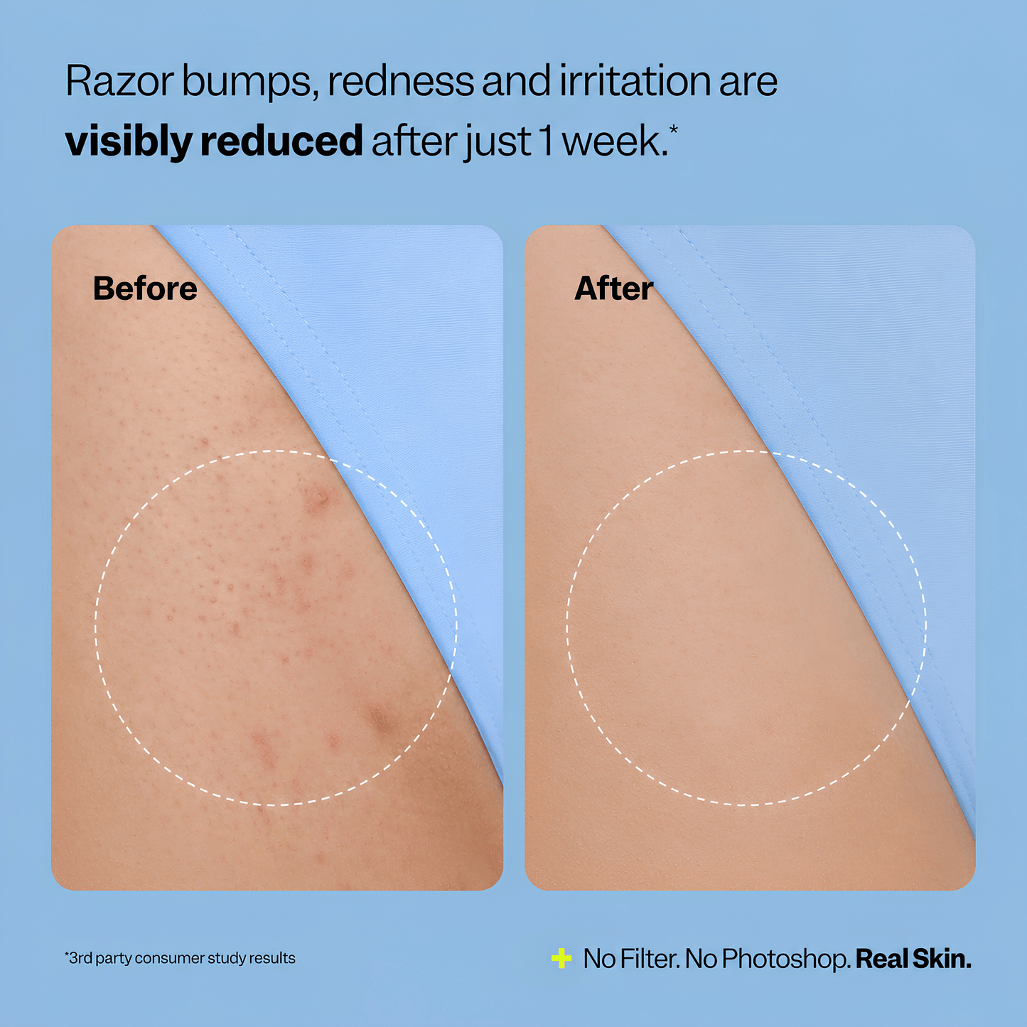 Rovelo Smoothing Solution