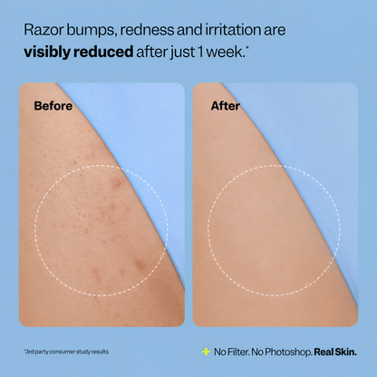 Rovelo Smoothing Solution